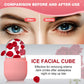 Silicone Face Ice Roller